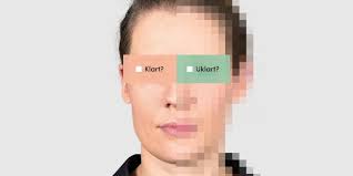 2 dager soling i solen som et resultat mottatten solbrenthet i ansiktet namazh rømme. Kampanje Alf Opheim Optikk