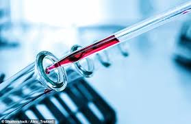 Important tools in early cancer detection, diagnosis and treatment. Nhs Trials Holy Grail Blood Test That Can Spot 50 Cancers Could Save Thousands Of Lives A Year Daily Mail Online