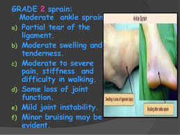 A grade i sprain is the least severe, while a grade iii ankle sprain is indicative of a significantly damaged ligament. Ankle Sprains