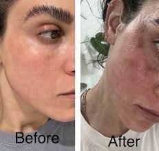 Malcolm A Lesavoy MD FACS, 421 N Rodeo Dr, Beverly Hills, CA 90210, US