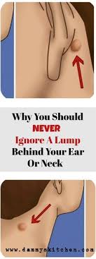 Why You Should Never Ignore A Lump Behind Your Ear Or Neck Lumps Ear Healthcare Health Skin Bumps Lump Behind Ear Neck