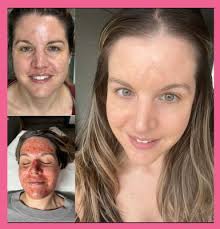 Modern Skin Solutions CT, 495 Gold Star Hwy, Ste 200, Groton, CT 06340, US 