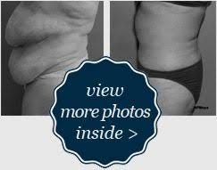 Moya Aesthetic Plastic Surgery Lewisburg Pa 17837 Board Certified Plastic Surgeon