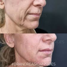 👨‍⚕️Plastic Surgeon