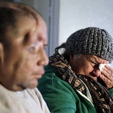 APNewsBreak: Man shot in head files claim against LAPD