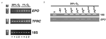 This growth factor induces proliferation and migration of vascular endothelial cells, and is essential for both physiological and pathological angiogenesis. Disruption Of Oxygen Homeostasis Underlies Congenital Chuvash Polycythemia Nature Genetics