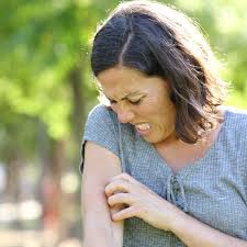 Image result for mite bites on humans