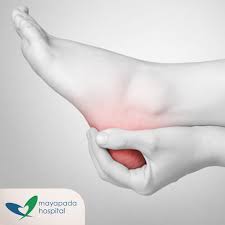Mayapada Hospital Apa Yang Membuat Kaki Anda Terasa Sakit Panas Atau Mati Rasa