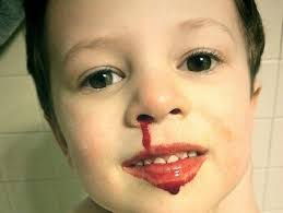 Istri di ajak menolak anak kandung jdi korban hingga hamil 2 kali. Tips Menghentikan Kebiasaan Anak Mengorek Upil Theasianparent Indonesia