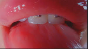 asmrレンズ舐めでスーパーピンク 👅