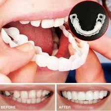 For people undergoing orthodontic treatment, food lodgement and metal appliances may so, if you are wearing braces then methods to whiten teeth include whitening toothpaste, home bleaching, and office bleaching. 1 Set Upper Lower Teeth Whitening Tooth Braces Simulation Brace Whitening Sleeve Smile Comfort Fit Denture Sleeve Oral Care Teeth Whitening Aliexpress