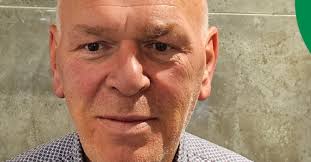 Image result for Acromegaly