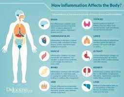 Pin On Healthy Living