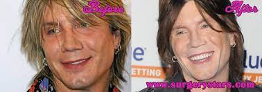 The final nightmare, city of angels, son in law, transformers and tommy boy, as well as a promotional video for their hometown nhl team buffalo sabres, the television show jericho, and promos for the 2008. John Rzeznik Plastic Surgery Before After Photos