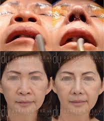 Donald B. Yoo, M.D., Inc.