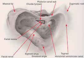 Image result for Ossicular Chain Disruption