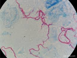 Mycobacterium tuberculosis – LaboATLAS