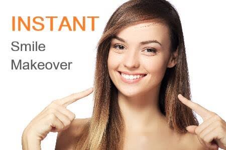 Composite Veneers product image