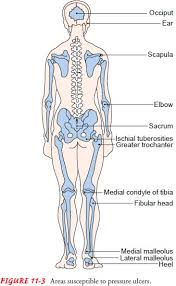 Atrophy is a huge problem with immobility. Nursing Process The Patient With Impaired Skin Integrity