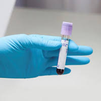 A positive skin test in someone who has never been treated for tb indicates that the tb bacillus is lying dormant in their body, even if it is not causing disease. Testing For Tb Infection Testing Diagnosis Tb Cdc