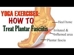 Yoga For Plantar Fasciitis Part 1 With Gwen Lawrence Youtube Plantar Fasciitis Exercises Yoga For Plantar Fasciitis Plantar Fasciitis