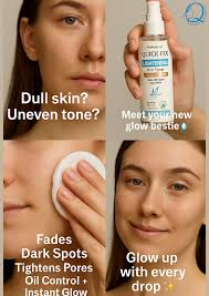 Dull Skin? Uneven Tone? Not Anymore! 💧 Meet your new glow bestie — Quick  Fix Lightening Skin Toner 🌿 Formulated to: ✓ Fade dark spots & freckles ✓  Tighten pores ✓ Control
