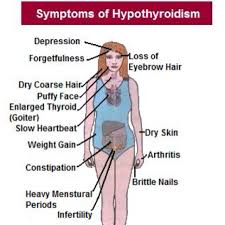 Basically Hypothyroidism Natural Treatment Hypothyroidism Underactive Thyroid