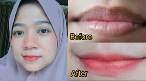 Salah satu tanda pecandu rokok adalah memiliki bibir menghitam, tidak hanya bibir hitam, bahaya merokok juga dapat merusak seluruh organ dan menjadi penyebab penyakit paling mematikan di dunia. Alpharad Sub Count Chu 11 Cara Alami Memerahkan Bibir Yang Hitam