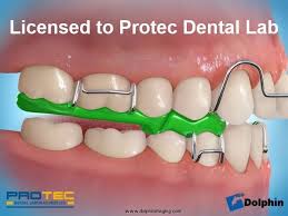 When they're putting the bite blocks on, the consistency of the bite block is like a thick glue.then it hardens on your tooth, and becomes as hard as a tooth. Pin On Dental