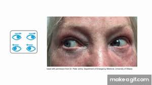 Image result for HiNTs Exam