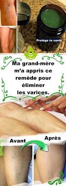 Pin On Soins Naturels