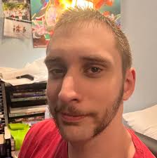 Experiencing multiple seizures in one day with epilepsy