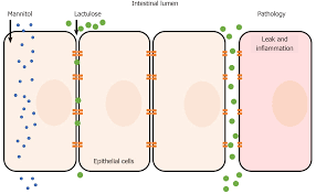 Zu hause sind die wasserleitungen beschädigt, sein sohn fritzli. Clinical Relevance Of Intestinal Barrier Dysfunction In Common Gastrointestinal Diseases