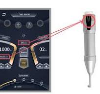 Prisma Q-Switch: Versatility in Pigment and Tattoo Removal