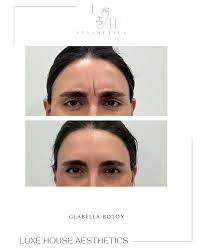 Plot twist 🥴 No Botox for baby bump season, but you can still glow with  our preg-safe skincare, lymphatic therapy of the face and other services  coming soon Benefits of lymphatic therapy: