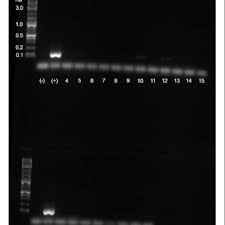 You have to vacuum and clean thoroughly to get rid of all the dead bed bugs, but you're this applies just as much to hiring an exterminator as it does to treat them yourself. Pdf Lack Of Influence By Endosymbiont Wolbachia On Virus Titer In The Common Bed Bug Cimex Lectularius