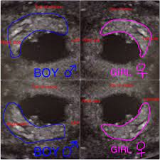 Pin On Gender Predictor Tests