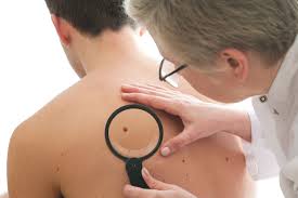 If you or your doctor finds an abnormal mole, you may need to have it removed. Radiofrequency Mole Removal Naturopathic Doctor News And Review