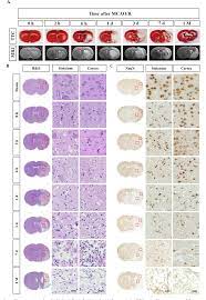 From the human protein atlas project page: Pdf Spatiotemporal Protein Atlas Of Cell Death Related Molecules In The Rat Mcao Stroke Model Semantic Scholar