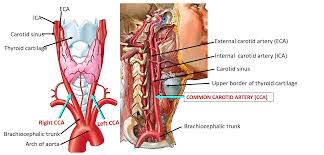 Image result for carotid artery