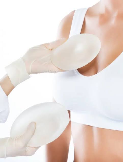 Breast augmentation in Paris - Prices and Techniques | Dr. B. Sarfati