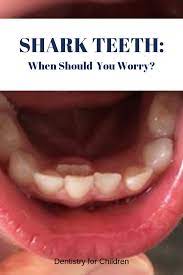 Shark Teeth When Should You Worry Dentistry For Children