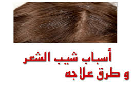 اسباب شيب الشعر وطرق وعلاجه نهائيا ظهور الشعر الابيض في فترة الشباب اجمل بنات