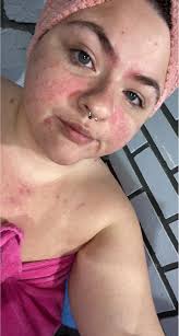 Hello. Need recommendations for face cream. I get dry skin