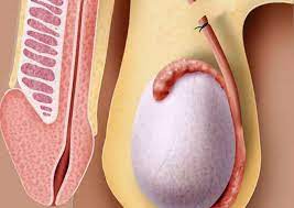 Este es un mito que ya no es válido en la actualidad por la existencia de la vasovasostomía, que. Faq Preguntas Frecuentes Sobre La Reversion De La Vasectomia Udu
