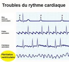 Mais, parfois, le cœur se met à battre rapidement et de manière inconstante. Mon Coeur S Est Mis A Battre Tres Vite Docteurclic Com