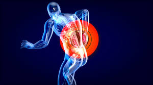 Fibromialgia sintomas iniciales el que te llevará a consultar al médico es el dolor continuo pero existen la fibromialgia es una enfermedad común que produce dolor y fatiga en los músculos, las. Fibromialgia A Sindrome Das Dores Inexplicaveis Unit Universidade Tiradentes A Melhor Particular Do Nordeste