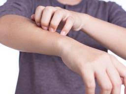 Does hand sanitiser kill viruses? How Long Is Ringworm Contagious What To Know