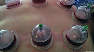 السلام عليكم نقدم لكم مجموعة كبيرة من الحكم والعبر والامثال الشعبية الالمانية و الكلام الجميل المعبر مكتوب بالالمانية ومعناه بالعربي فلنبدء أمثال. Ù…Ù‡Ø§Ø¬Ø±ÙˆÙ† Ø¹Ø±Ø¨ ÙŠØ¹Ø§Ù„Ø¬ÙˆÙ† Ø¨Ø§Ù„Ø­Ø¬Ø§Ù…Ø© ÙˆØ§Ù„Ø·Ø¨ Ø§Ù„Ø´Ø¹Ø¨ÙŠ Ø§Ù„Ù‚Ø¯ÙŠÙ… Ù…Ø¹Ù„ÙˆÙ…Ø§Øª Ù„Ù„Ø§Ø¬Ø¦ÙŠÙ† Dw 27 03 2014