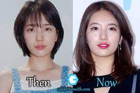 Select from 204 premium suzy bae of the highest quality. Bae Suzy Plastic Surgery Eyelid Nose Surgery Rumors Before After Pics Celebritieswith Com